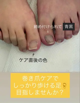 ネイル 永田 有美のネイルデザイン