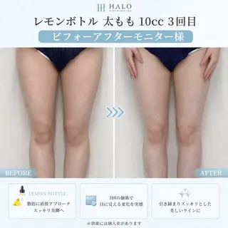 小顔痩身HALO 二宮早織のエステ・リラクイメージ