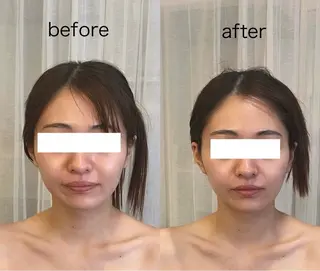 total beauty Aimのエステ・リラクイメージ