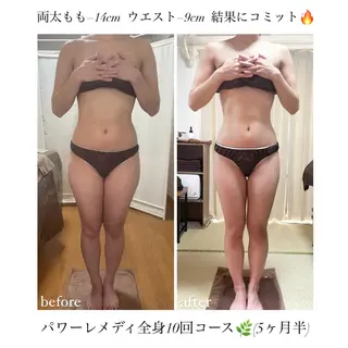 《本気痩せ×疲労改善 》  BILOOPのエステ・リラクイメージ