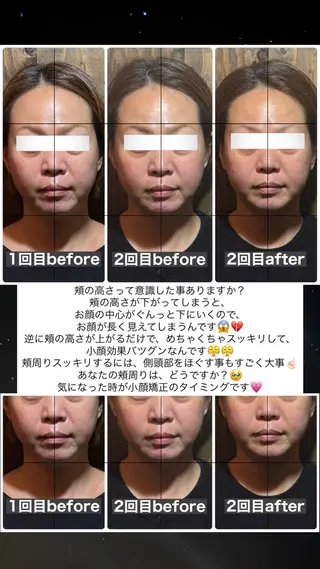 💎後悔させない小顔 矯正💎イトヤマ🌱のエステ・リラクイメージ