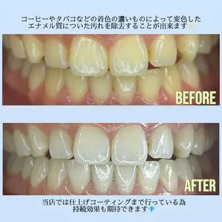 古賀/ホワイトニング MAYUのその他イメージ