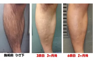 サロン リベル YUKAのエステ・リラクイメージ