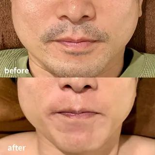 メンズ RICCO 堺の眉毛・アイブロウイメージ