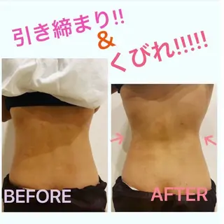 ITO  SALON 小顔・痩身・肌質改善のエステ・リラクイメージ