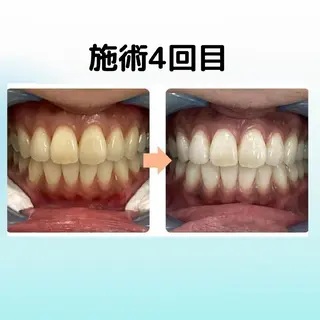 ホワイトニング シャトンのその他イメージ