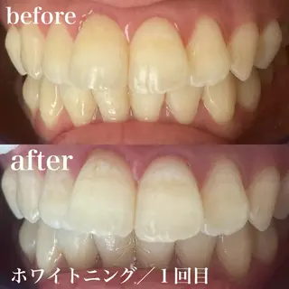 磐田|LAYLA 一番丁寧な脱毛店のエステ・リラクイメージ