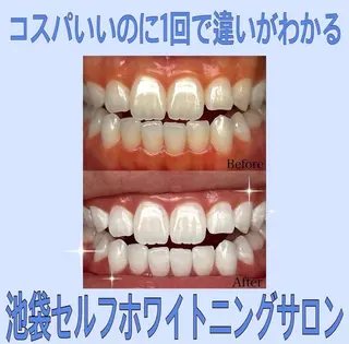 ホワイトニングジム 池袋のその他イメージ