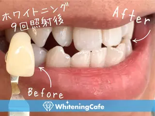 ホワイトニングカフェ 徳島沖浜店のその他イメージ