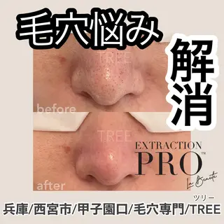 まつげ、毛穴 TREEのエステ・リラクイメージ