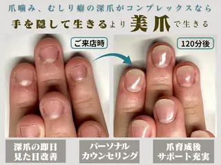 ネイル 深爪矯正専門店 ネイルサロンKUUのネイルデザイン