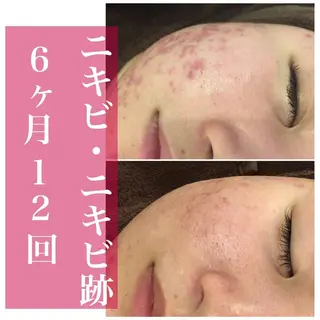 セミロング カラー パーマ ヘアアレンジ メンズ キッズ ネイル マツエク・マツパ 美容まるっと ビヨマルのエステ・リラクイメージ