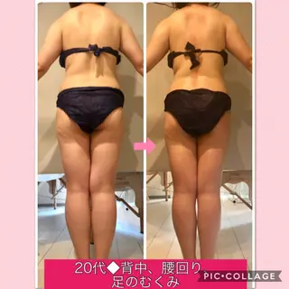 ショート カラー パーマ ヘアアレンジ メンズ キッズ ネイル マツエク・マツパ 痩身&ボディ 結果出し🌟丹野のエステ・リラクイメージ