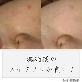 ニキビ経験者が施術 する専門サロン🌻のエステ・リラクイメージ