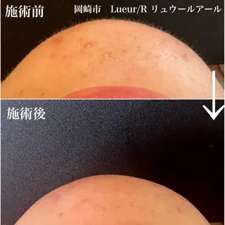 大久保 里奈のエステ・リラクイメージ