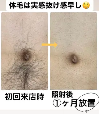 メンズ脱毛サロン Le falcoのエステ・リラクイメージ