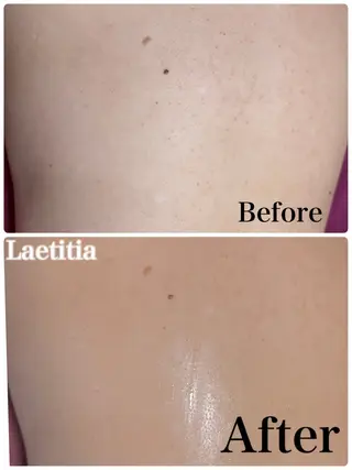 レティティア (Laetitia)のエステ・リラクイメージ