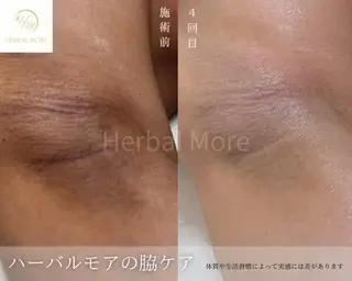 脱毛・眉毛・フェイス サロンN久留米店の眉毛・アイブロウイメージ