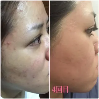 viage 脱毛&フェイシャル店のエステ・リラクイメージ