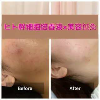 gomi sayakaのエステ・リラクイメージ