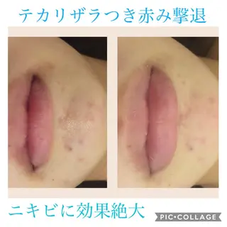 セミロング カラー パーマ ヘアアレンジ キッズ ネイル マツエク・マツパ EnsorClair 代表 野口真央のエステ・リラクイメージ