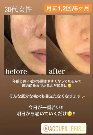 ミディアム カラー パーマ ヘアアレンジ メンズ キッズ ネイル マツエク・マツパ ニキビ・肌質改善専門 ♡人生が変わるサロンのエステ・リラクイメージ