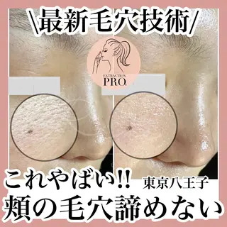 毛穴特化エステ -リールのエステ・リラクイメージ