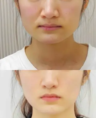 ネイル 愛維美水光専門店 川崎彩鳳のエステ・リラクイメージ