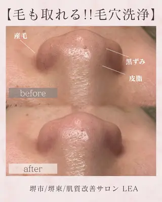 Lea堺東　　眉毛| 毛穴洗浄|顔WAXの眉毛・アイブロウイメージ
