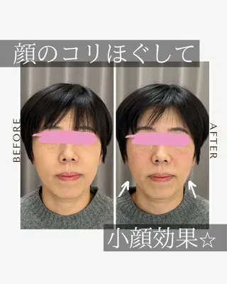 《美肌･小顔》美容鍼 ＆マッサージ＊MEIのエステ・リラクイメージ