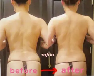 infini アンフィニのエステ・リラクイメージ