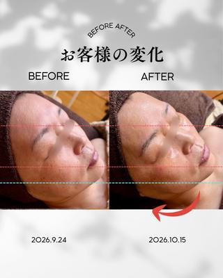 【豊明市】肌質改善 ・痩身サロンルシアのエステ・リラクイメージ