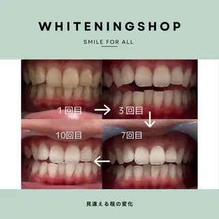 ホワイトニング ショップ船橋店のエステ・リラクイメージ