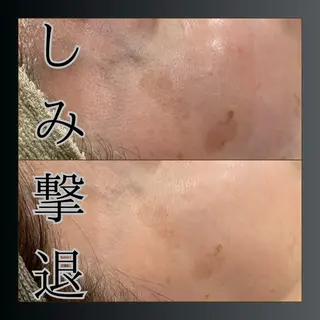 LiZA エステティックサロンのエステ・リラクイメージ