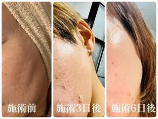 毛穴・肌質改善サロン ✨Tomaのエステ・リラクイメージ