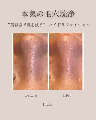 hue. YUKAのエステ・リラクイメージ