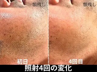 脱毛サロン FIS武蔵小杉店のエステ・リラクイメージ