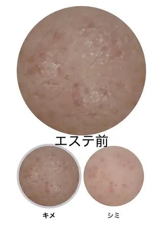 小倉 麻由のエステ・リラクイメージ