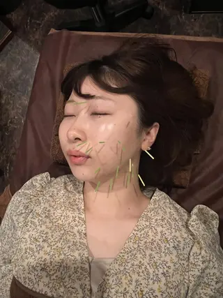 メンズ 美容鍼灸サロン LOMIHARIのエステ・リラクイメージ