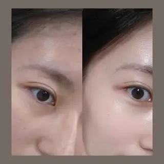 愛維美水光美肌専門店 メンズレディースokのエステ・リラクイメージ