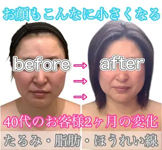 痩身ダイエット&小顔 🩷アールズスリムのエステ・リラクイメージ