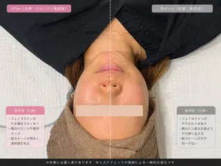 マツエク・マツパ 愛維美水光美肌専門店 メンズレディースokのエステ・リラクイメージ