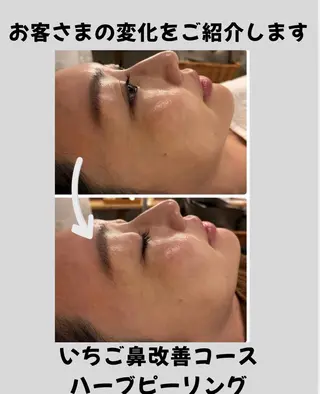 中平 あきなのエステ・リラクイメージ