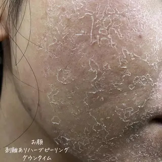 肌質改善サロン renew/ウエキのエステ・リラクイメージ