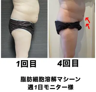 ネイル・エステサロン UILANIのエステ・リラクイメージ