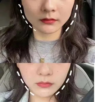 マツエク・マツパ 愛維美水光美肌専門店 メンズレディースokのエステ・リラクイメージ