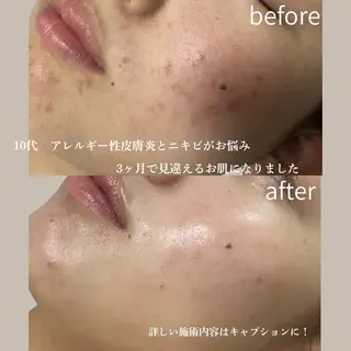 脱毛専門 ページ/Bloomのエステ・リラクイメージ