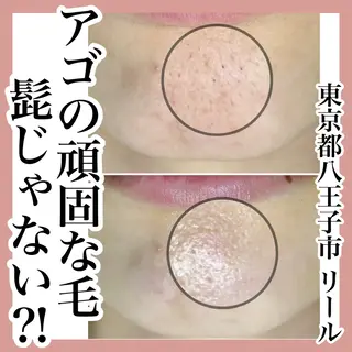 毛穴特化エステ -リールのエステ・リラクイメージ