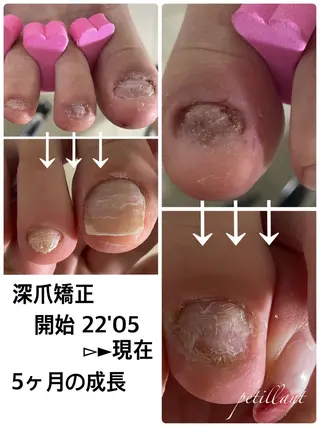 ネイル nail salon petillantのネイルデザイン