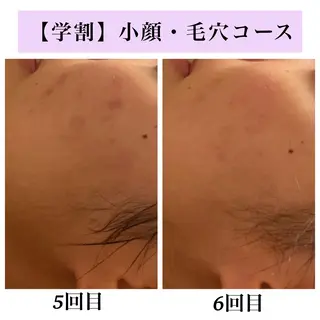 Bellesthe (ベルエステ)のエステ・リラクイメージ